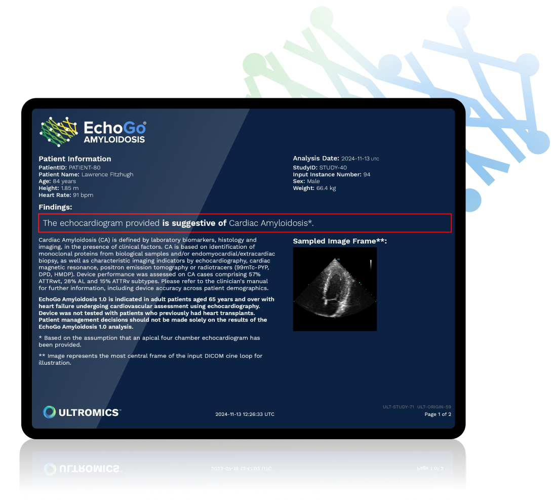 Amyloidosis